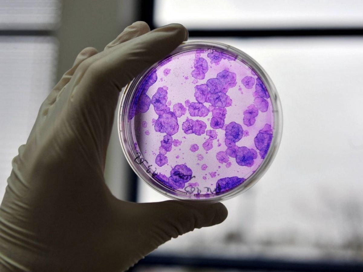 Le Japon autorise un premier traitement contre Parkinson à base de cellules iPS